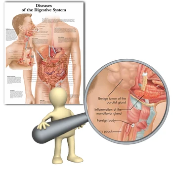 Sistemul digestiv Imagini Diagrame Anatomice Și Postere Anatomie Diagrame Boli Poze de Perete pentru Educație Medicală Medici